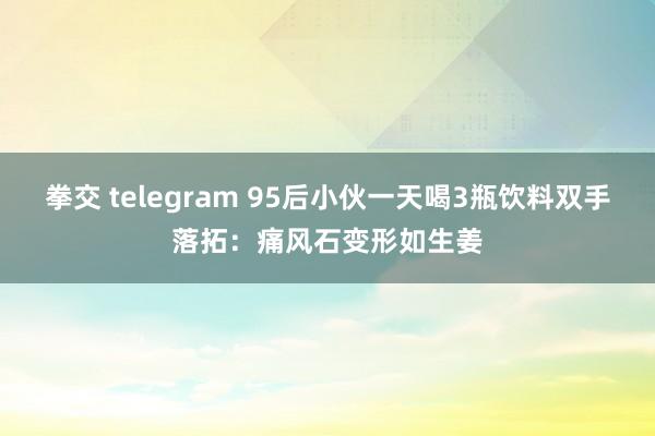 拳交 telegram 95后小伙一天喝3瓶饮料双手落拓：痛风石变形如生姜